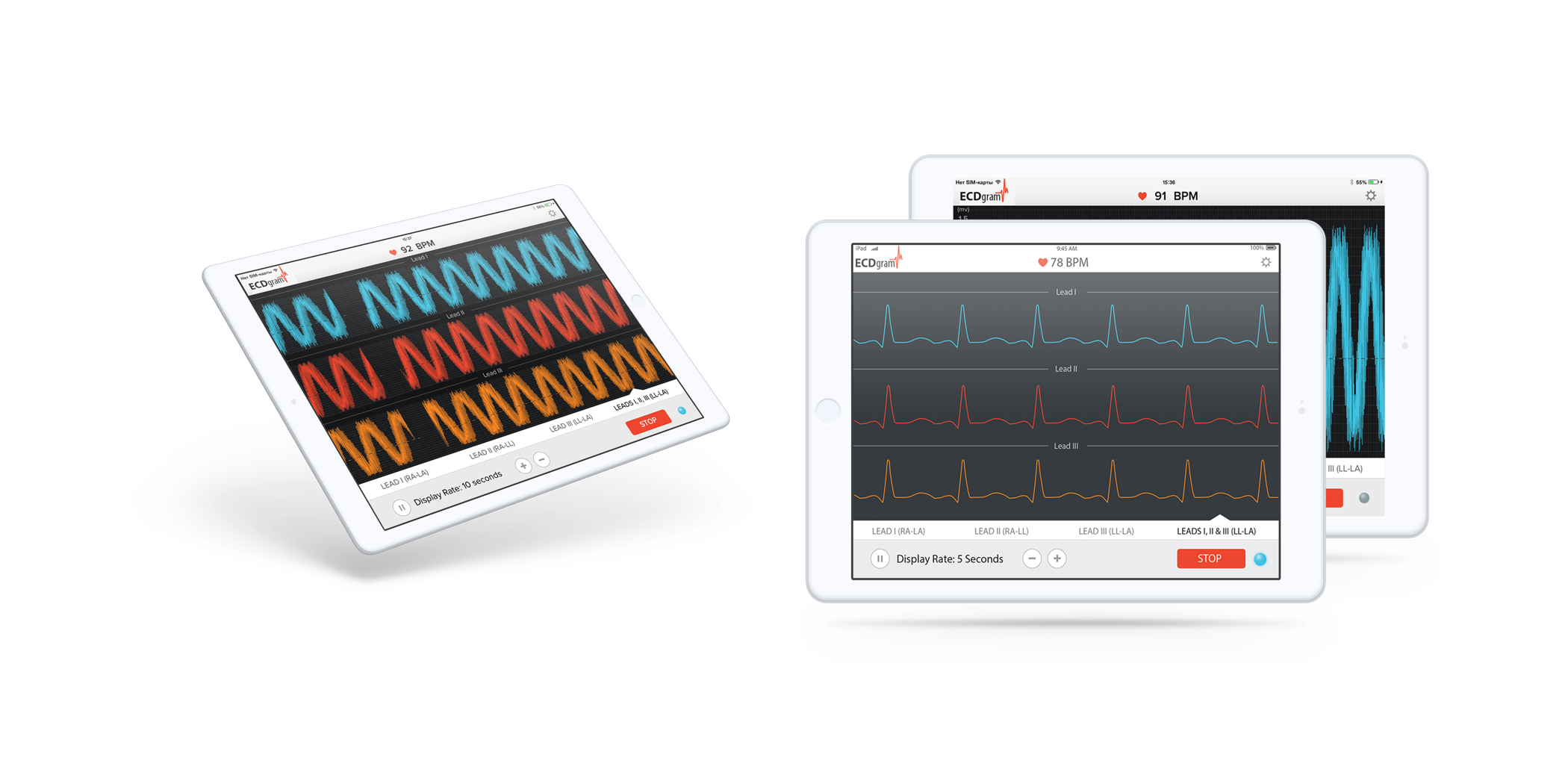 Medical app for real-time EKG sensor data visualization